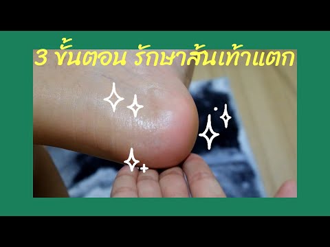 รักษาส้นเท้าแตก 3 ขั้นตอนเห็นผล​ ง่ายทำได้ทุกวัน พอลก้า Polka Cracked Heel Cream