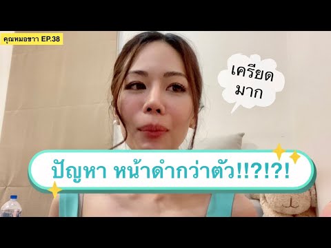 ปัญหาหน้าดำกว่าตัว!?! | EP.38